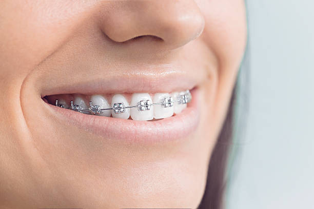 Best Invisalign and Clear Aligners  in Avenel, NJ